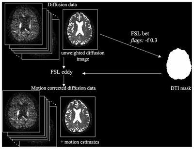 Evaluation of Field Map and Nonlinear Registration Methods for Correction of Susceptibility Artifacts in Diffusion MRI